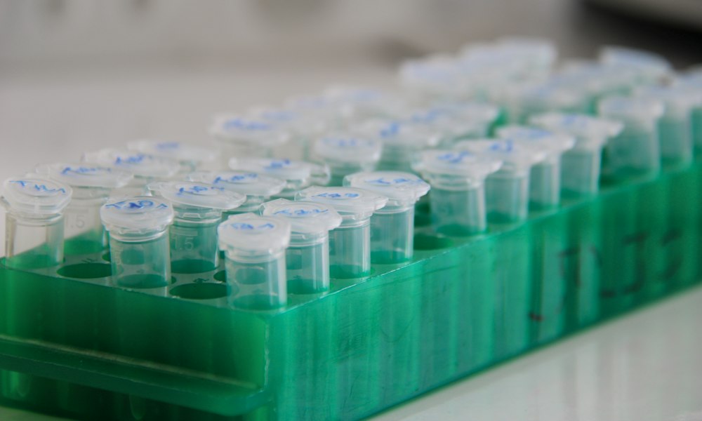 Mesterolon en de eigen testosteronproductie